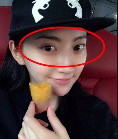 双眼皮怎么割没肉条感,双眼皮怎么显得更宽