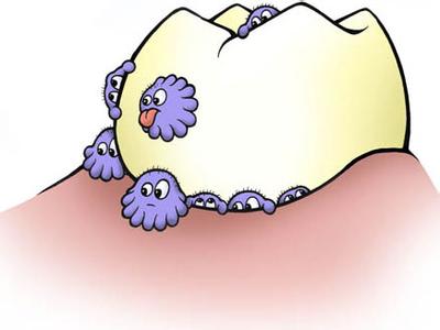 为什么晚上刷了牙，睡醒一觉还是会口臭？