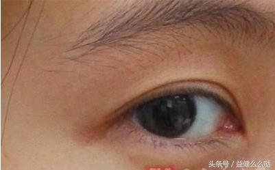 怎么让眼睛看起来不呆滞,怎样让眼睛看起来有精神不虚