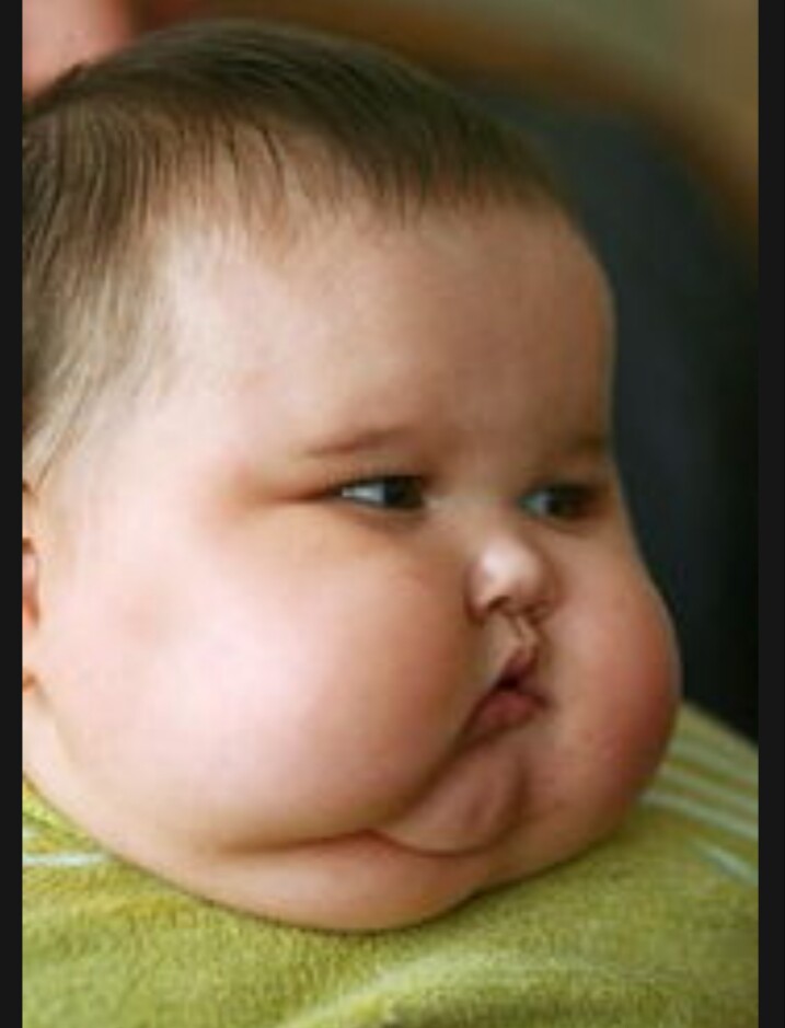 有哪些遗传病会传给下一代呢,有家族遗传病能治愈吗