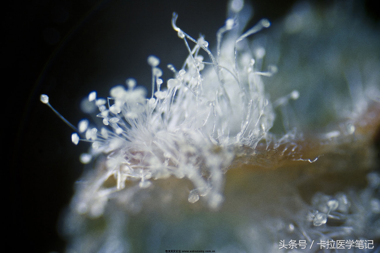 春季总是犯鼻炎或皮肤过敏，盘点10种过敏原的预防