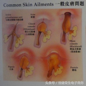 不要小看这些症状,不要小看你的疾病