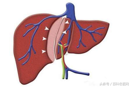 肝火旺的10大常见表现,肝火旺的10大症状及调理方法