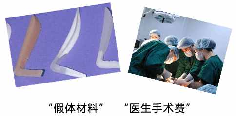 隆鼻价格一览表了解下不花冤枉钱,隆鼻价目表曝光及案例