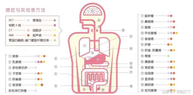 国外癌症筛查,日本有名医院癌研所治疗费用