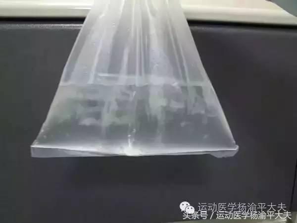 大夫把患者胳膊掰断了怎么赔,医生胳膊酸怎么办