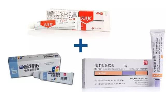 治疗银屑病的药膏低价,专治银屑病的膏药