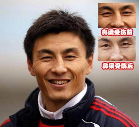 李玮锋大头,李玮峰亚洲杯视频