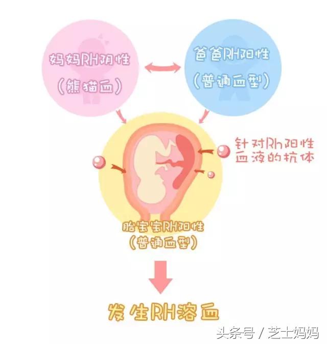 熊猫血和啥血型正常生娃,熊猫血生二胎真的难吗