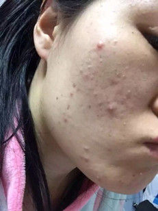 屁股大腿粗是哪里出问题啦,屁股大是湿气大吗