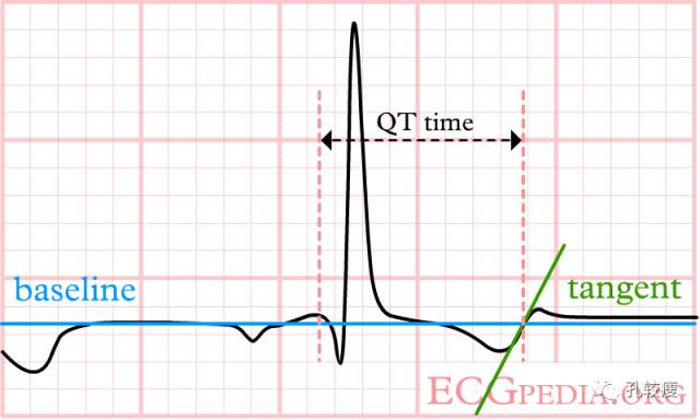 qt和qtc间期正常值范围,qtc间期