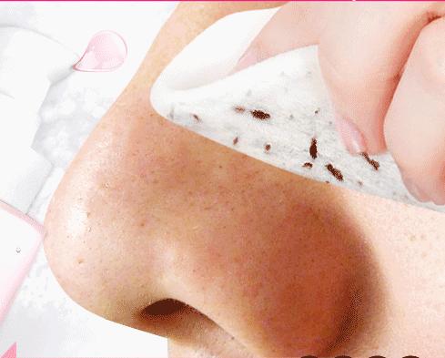 脸多油毛孔粗大黑头粉刺,修复面部毛孔黑头的方法