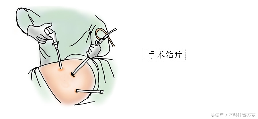 痛经有可能是癌症吗,痛经可能是妇科炎症吗