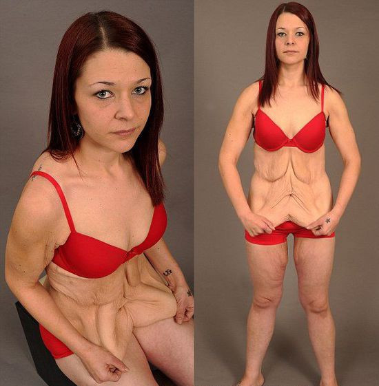 胖女二婚,二婚胖女孩减肥