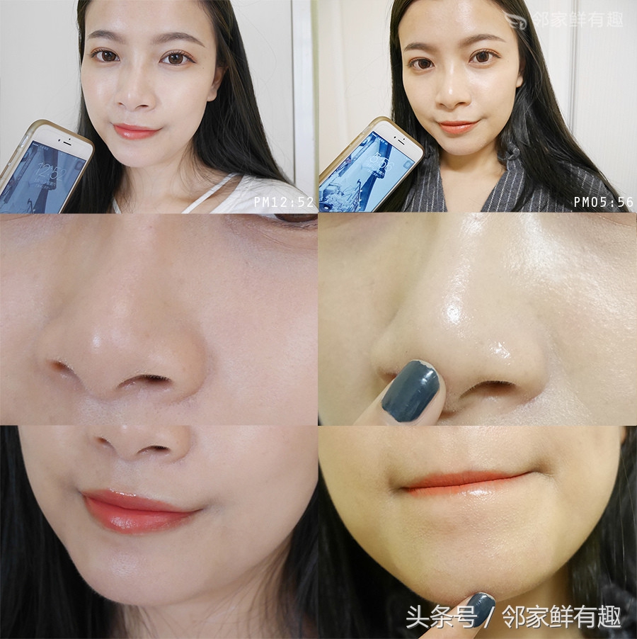 消灭敏感泛红皮肤，玻尿酸让你清爽一整个春夏