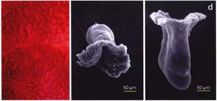 普通内镜与Pitpattern分型（多图详解）