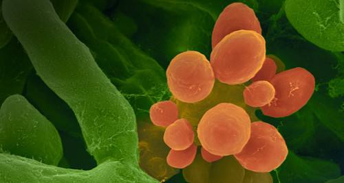 对灰尘过敏怎么改善体质,怎么改善湿疹引起的过敏的体质