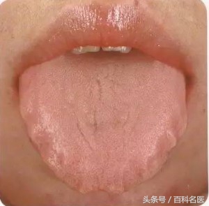 舌头舌诊,如何快速辨舌诊