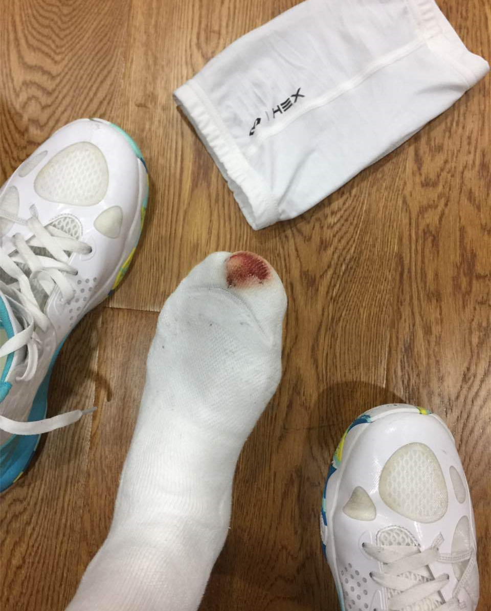 运动员的背后你知多少?训练练到双膝红肿淤青,甚至脚趾盖磨掉!