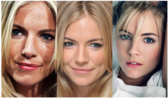 国外怎么祛除雀斑的方法,美国以雀斑为美