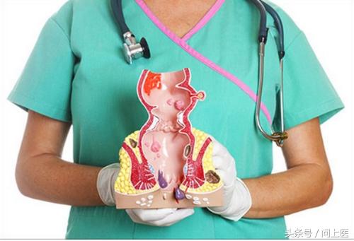 肛肠疾病你到底了解多少,痔疮知识自测