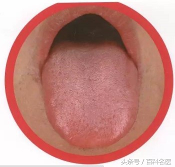 舌头舌诊,如何快速辨舌诊