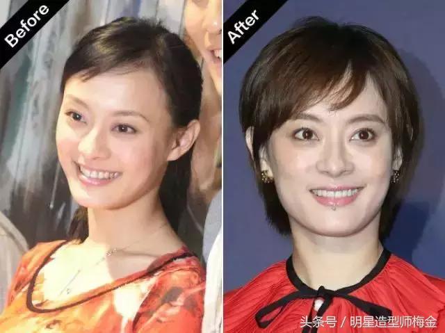 天生发量少怎么增多,天生发量少是缺什么