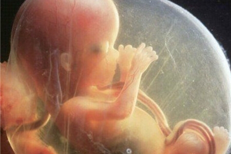 孕晚期羊水过少能顺产吗,孕晚期羊水深度多少能增加羊水