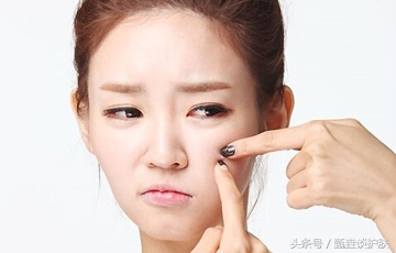 战痘神器推荐,战痘神器