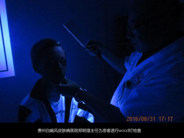 不是白癜风的白斑能查出是什么吗,不是白癜风的白点是啥