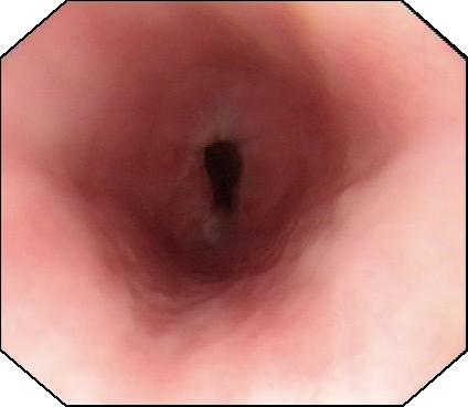 腹胀下肢浮肿怎么回事,不明原因的呕吐腹泻怎么回事