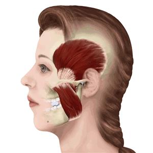 牙套脸怎么矫正最有效,牙套脸怎么防止掉