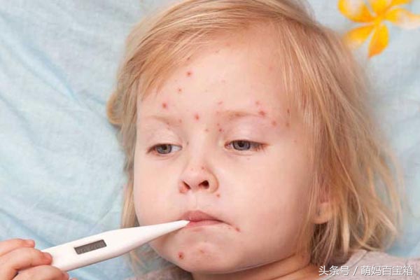 宝宝长水痘期间的饮食宜忌，辅食调养食谱，收藏篇（八）