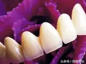 烤瓷牙的4大危害要当心,烤瓷牙的寿命是几年怎么保护