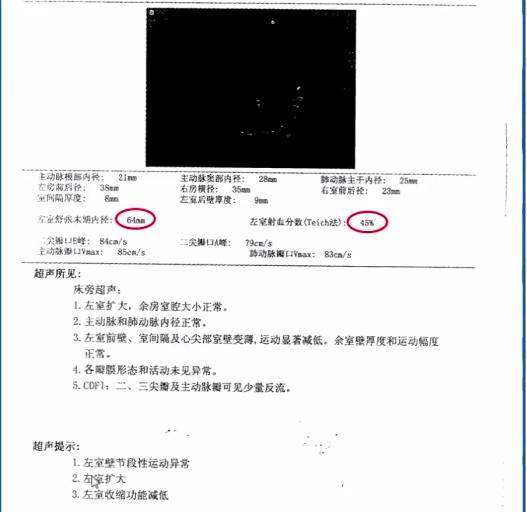 冠状动脉粥样硬化性心脏病知识点,冠状动脉粥样硬化性心脏病怎样治