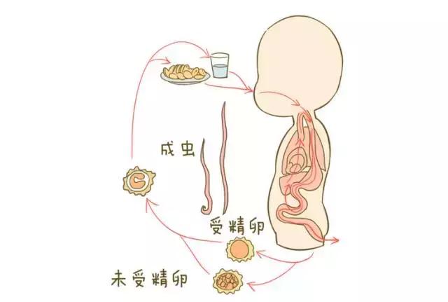 肚子有蛔虫需要注意什么,小孩打蛔虫的注意事项