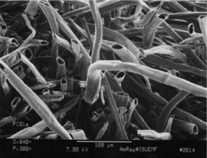 杨柳絮过敏去医院有用吗,杨柳絮和花粉过敏一样吗