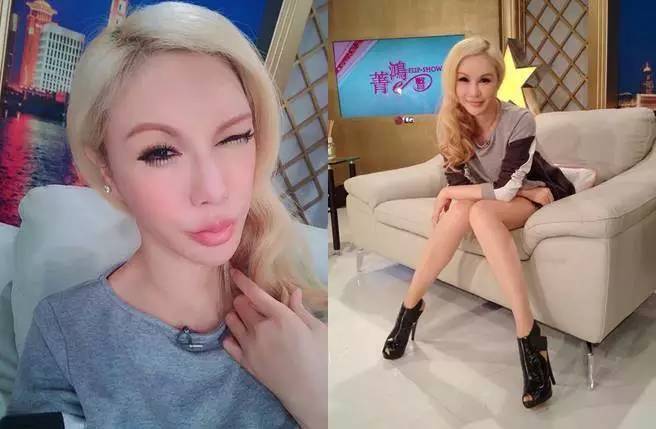 井柏然撞脸金城武，“僵硬”神器玻尿酸这次反而救了人？