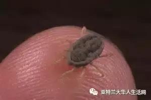 咬到嘴边肉和中风前兆有关系吗,舌头被牙齿咬到是脑中风的前兆吗