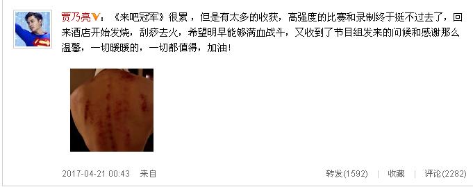 刮痧真的能去火吗？一男星录节目病倒刮痧去火引争议