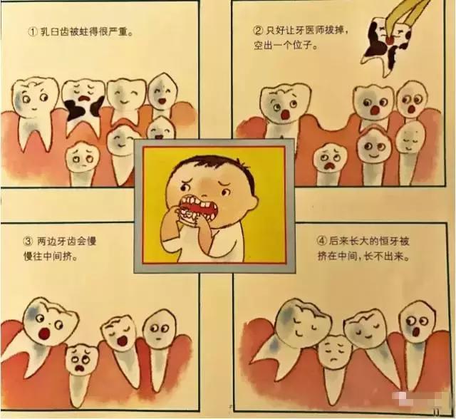 乳牙到底要不要根管治疗,儿童乳牙是全部要换的吗