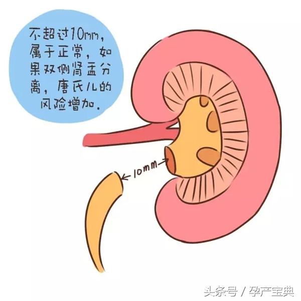 孕期小知识图文,孕期小知识关于胎儿缺氧的