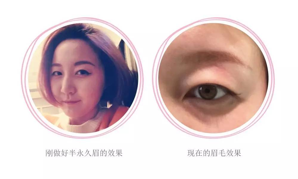 为什么现在都是半永久纹眉,到底建议不建议纹眉呢图片