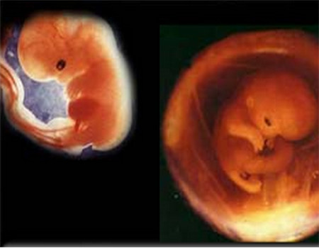 怀孕1个月孕妈根本没啥知觉？其实这些小症状不少孕妈都曾遇过