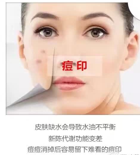 假性过敏的症状及治疗,什么是过敏怎么治