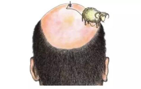 脱发停不下来1招教你防脱发,脱发严重这个防脱发妙招很好用