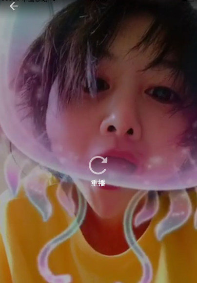 郑爽压力大深夜失眠嘴角上火，头发凌乱还不忘卖萌放飞自我！