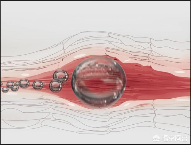 输液时如果空气进入了血管，会有什么后果？
