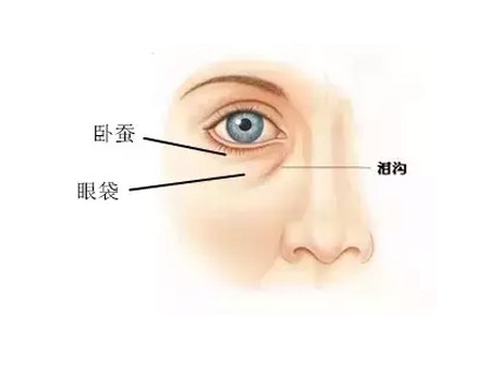 为啥大部分男生没有卧蚕,为什么直男不懂卧蚕