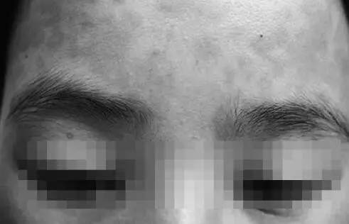 吃螃蟹小心食物中毒,吃螃蟹全身红肿